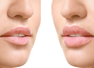 Powiększanie i modelowanie ust. Nadaj ustom nowy kształt! Powiększanie i modelowanie ust. Nadaj ustom nowy kształt!